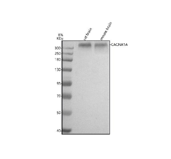 Western blot analysis of CACNA1A using anti-CACNA1A antibody. Lane 1: rat brain tissue lysates, Lane 2: mouse brain tissue lysates. After electrophoresis, proteins were transferred to a nitrocellulose membrane at 150 mA for 50-90 minutes. Blocked the membrane with 5% non-fat milk/TBS for 1.5 hour at RT. The membrane was incubated with rabbit anti-CACNA1A antibody at 0.5 ug/ml overnight at 4oC, then washed with TBS-0.1%Tween 3 times with 5 minutes each and probed with a goat anti-rabbit IgG-HRP secondary antibody at a dilution of 1:5000 for 1.5 hour at RT. The signal was developed using enhanced chemiluminescent. CACNA1A western blot of rat and mouse brain shows a broad band at ~300-320 kDa, consistent with full-length Cav2.1 running higher than predicted due to extensive glycosylation and large membrane protein migration properties.