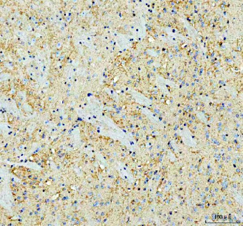 Immunohistochemical staining of SNCA using anti-SNCA antibody. SNCA was detected in a paraffin-embedded section of mouse brain tissue. Heat mediated antigen retrieval was performed in EDTA buffer (pH 8.0, epitope retrieval solution). The tissue section was blocked with 10% goat serum. The tissue section was then incubated with 2 ug/ml rabbit anti-SNCA antibody overnight at 4oC. Peroxidase Conjugated Goat Anti-rabbit IgG was used as secondary antibody and incubated for 30 minutes at 37oC. The tissue section was developed using an HRP secondary and DAB substrate.