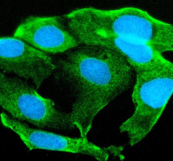 Immunofluorescent staining of STYK1 using anti-STYK1 antibody. STYK1 was detected in an immunocytochemical section of Caco-2 cells. Enzyme antigen retrieval was performed using IHC enzyme antigen retrieval reagent for 15 mins. The cells were blocked with 10% goat serum. And then incubated with 5 ug/ml rabbit anti-STYK1 antibody overnight at 4oC. DyLight 488 Conjugated Goat Anti-Rabbit IgG was used as secondary antibody at 1:500 dilution and incubated for 30 minutes at 37oC. The section was counterstained with DAPI nuclear stain (blue). Visualize using a fluorescence microscope and filter sets appropriate for the label used.