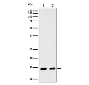 Western blot analysis of CRABP2 expression in (1) human MCF7 cell lysate; (2) mouse skin lysate. Predicted molecular weight ~16 kDa.