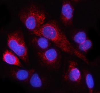 Immunofluorescent staining of NUP98 using anti-NUP98 antibody (red). NUP98 was detected in an immunocytochemical section of cells. Enzyme antigen retrieval was performed using IHC enzyme antigen retrieval reagent for 15 mins. The cells were blocked with 10% goat serum. And then incubated with 5 ug/ml rabbit anti-NUP98 antibody overnight at 4oC. Cy3 Conjugated Goat Anti-Rabbit IgG was used as secondary antibody at 1:500 dilution and incubated for 30 minutes at 37oC. The section was counterstained with DAPI nuclear stain (blue). Visualize using a fluorescence microscope and filter sets appropriate for the label used.