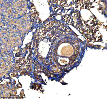 Immunohistochemical staining of GSTM2 using anti-GSTM2 antibody. GSTM2 was detected in a paraffin-embedded section of mouse ovary tissue. Heat mediated antigen retrieval was performed in EDTA buffer (pH 8.0, epitope retrieval solution). The tissue section was blocked with 10% goat serum. The tissue section was then incubated with 2 ug/ml rabbit anti-GSTM2 antibody overnight at 4oC. Peroxidase Conjugated Goat Anti-rabbit IgG was used as secondary antibody and incubated for 30 minutes at 37oC. The tissue section was developed using an HRP secondary and DAB substrate.