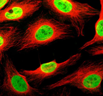 Immunofluorescent staining of THYN1 using anti-THYN1 antibody (green) and anti-Alpha Tubulin antibody (red). THYN1 was detected in an immunocytochemical section of U2OS cells. Enzyme antigen retrieval was performed using IHC enzyme antigen retrieval reagent for 15 mins. The cells were blocked with 10% goat serum. And then incubated with 5 ug/ml rabbit anti-THYN1 antibody and mouse anti-Beta Tubulin antibody overnight at 4oC. DyLight 488 Conjugated Goat Anti-Rabbit IgG and Cy3 Conjugated Goat Anti-Mouse IgG were used as secondary antibody at 1:500 dilution and incubated for 30 minutes at 37oC. Visualize using a fluorescence microscope and filter sets appropriate for the label used.