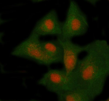Immunofluorescent staining of NSMCE4A using anti-NSMCE4A antibody (red) and anti-Beta Tubulin antibody (green). NSMCE4A was detected in immunocytochemical section of cell. Enzyme antigen retrieval was performed using IHC enzyme antigen retrieval reagent for 15 mins. The cells were blocked with 10% goat serum. And then incubated with 5 ug/ml rabbit anti-NSMCE4A antibody and mouse anti-Beta Tubulin antibody overnight at 4oC. Cy3 Conjugated Goat Anti-Rabbit IgG and DyLight 488 Conjugated Goat Anti-Mouse IgG were used as secondary antibody at 1:500 dilution and incubated for 30 minutes at 37oC. Visualize using a fluorescence microscope and filter sets appropriate for the label used.