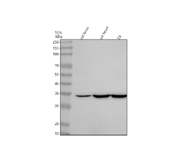 Western blot analysis of NTMT2 using anti-NTMT2 antibody. Lane 1: rat brain tissue lysates, Lane 2: rat heart tissue lysates, Lane 3: rat C6 whole cell lysates. After electrophoresis, proteins were transferred to a nitrocellulose membrane at 150 mA for 50-90 minutes. Blocked the membrane with 5% non-fat milk/TBS for 1.5 hour at RT. The membrane was incubated with rabbit anti-NTMT2 antibody at 0.5 ug/ml overnight at 4oC, then washed with TBS-0.1%Tween 3 times with 5 minutes each and probed with a goat anti-rabbit IgG-HRP secondary antibody at a dilution of 1:5000 for 1.5 hour at RT. The signal was developed using enhanced chemiluminescent. A specific band was detected for NTMT2 at approximately 32 kDa. The expected molecular weight of NTMT2 is ~32 kDa.