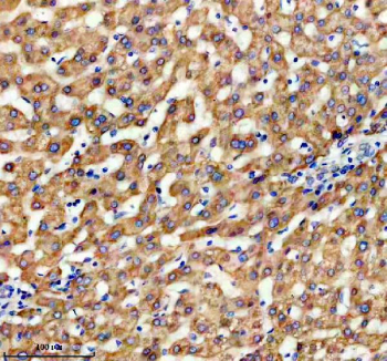 Immunohistochemical staining of TIMM9 using anti-TIMM9 antibody. TIMM9 was detected in a paraffin-embedded section of human liver tissue. Heat mediated antigen retrieval was performed in EDTA buffer (pH 8.0, epitope retrieval solution). The tissue section was blocked with 10% goat serum. The tissue section was then incubated with 2 ug/ml rabbit anti-TIMM9 antibody overnight at 4oC. Peroxidase Conjugated Goat Anti-rabbit IgG was used as secondary antibody and incubated for 30 minutes at 37oC. The tissue section was developed using an HRP secondary and DAB substrate.