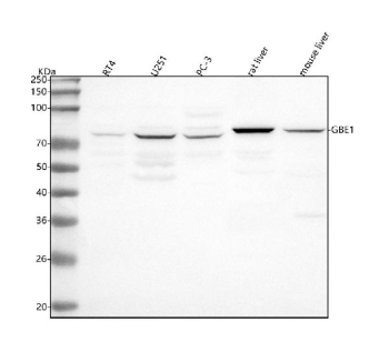 Western blot analysis of GBE1 using anti-GBE1 antibody. Lane 1: human RT4 whole cell lysates, Lane 2: human U251 whole cell lysates, Lane 3: human PC-3 whole cell lysates, Lane 4: rat liver tissue lysates, Lane 5: mouse liver tissue lysates. After electrophoresis, proteins were transferred to a nitrocellulose membrane at 150 mA for 50-90 minutes. Blocked the membrane with 5% non-fat milk/TBS for 1.5 hour at RT. The membrane was incubated with rabbit anti-GBE1 antibody at 0.5 ug/ml overnight at 4oC, then washed with TBS-0.1%Tween 3 times with 5 minutes each and probed with a goat anti-rabbit IgG-HRP secondary antibody at a dilution of 1:5000 for 1.5 hour at RT. The signal was developed using enhanced chemiluminescent. A specific band was detected for GBE1 at approximately 80 kDa. The expected molecular weight of GBE1 is ~80 kDa.