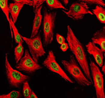 Immunofluorescent staining of POLD1 using anti-POLD1 antibody (green) and anti-Beta Tubulin antibody (red). POLD1 was detected in an immunocytochemical section of U2OS cells. Enzyme antigen retrieval was performed using IHC enzyme antigen retrieval reagent for 15 mins. The cells were blocked with 10% goat serum. And then incubated with 5 ug/ml rabbit anti-POLD1 antibody and mouse anti-Beta Tubulin antibody overnight at 4oC. DyLight 488 Conjugated Goat Anti-Rabbit IgG and Cy3 Conjugated Goat Anti-Mouse IgG were used as secondary antibody at 1:500 dilution and incubated for 30 minutes at 37oC. Visualize using a fluorescence microscope and filter sets appropriate for the label used.