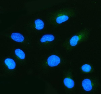 Immunofluorescent staining of NUDT9 using anti-NUDT9 antibody (green). NUDT9 was detected in an immunocytochemical section of cells. Enzyme antigen retrieval was performed using IHC enzyme antigen retrieval reagent for 15 mins. The cells were blocked with 10% goat serum. And then incubated with 5 ug/ml rabbit anti-NUDT9 antibody overnight at 4oC. DyLight 488 Conjugated Goat Anti-Rabbit IgG was used as secondary antibody at 1:500 dilution and incubated for 30 minutes at 37oC. The section was counterstained with DAPI nuclear stain (blue). Visualize using a fluorescence microscope and filter sets appropriate for the label used.