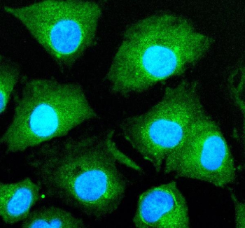 Immunofluorescent staining of HJURP using anti-HJURP antibody (green). HJURP was detected in an immunocytochemical section of cells. Enzyme antigen retrieval was performed using IHC enzyme antigen retrieval reagent for 15 mins. The cells were blocked with 10% goat serum. And then incubated with 5 ug/ml rabbit anti-HJURP antibody overnight at 4oC. DyLight 488 Conjugated Goat Anti-Rabbit IgG was used as secondary antibody at 1:500 dilution and incubated for 30 minutes at 37oC. The section was counterstained with DAPI nuclear stain (blue). Visualize using a fluorescence microscope and filter sets appropriate for the label used.