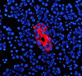 Immunofluorescent staining of ZNT8/SLC30A using anti-SLC30A antibody (red). ZNT8/SLC30A was detected in a paraffin-embedded section of human pancreas tissue. Heat mediated antigen retrieval was performed in EDTA buffer (pH 8.0, epitope retrieval solution). The tissue section was blocked with 10% goat serum. The tissue section was then incubated with 5 ug/ml rabbit anti-SLC30A antibody overnight at 4oC. Cy3 Conjugated Goat Anti-Rabbit IgG was used as secondary antibody at 1:500 dilution and incubated for 30 minutes at 37oC. The section was counterstained with DAPI nuclear stain (blue). Visualize using a fluorescence microscope and filter sets appropriate for the label used.