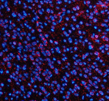 Immunofluorescent staining of SLC7A14 using anti-SLC7A14 antibody (red). SLC7A14 was detected in a paraffin-embedded section of rat brain tissue. Heat mediated antigen retrieval was performed in EDTA buffer (pH 8.0, epitope retrieval solution). The tissue section was blocked with 10% goat serum. The tissue section was then incubated with 5 ug/ml rabbit anti-SLC7A14 antibody overnight at 4oC. Cy3 Conjugated Goat Anti-Rabbit IgG was used as secondary antibody at 1:500 dilution and incubated for 30 minutes at 37oC. The section was counterstained with DAPI nuclear stain (blue). Visualize using a fluorescence microscope and filter sets appropriate for the label used.
