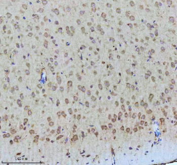 Immunohistochemical staining of Tuberin/TSC2 (Phospho-S939) using anti-Phospho-Tuberin (Ser939) antibody. Tuberin/TSC2 (Phospho-S939) was detected in a paraffin-embedded section of mouse brain tissue. Heat mediated antigen retrieval was performed in EDTA buffer (pH 8.0, epitope retrieval solution). The tissue section was blocked with 10% goat serum. The tissue section was then incubated with a dilution of 1:50 rabbit anti-Phospho-Tuberin (Ser939) antibody overnight at 4oC. Peroxidase Conjugated Goat Anti-rabbit IgG was used as secondary antibody and incubated for 30 minutes at 37oC. The tissue section was developed using an HRP secondary and DAB substrate.