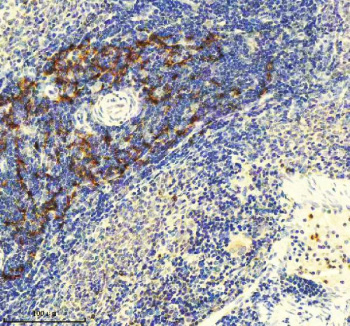 Immunohistochemical staining of GLIPR2 using anti-GLIPR2 antibody. GLIPR2 was detected in a paraffin-embedded section of rat spleen tissue. Heat mediated antigen retrieval was performed in EDTA buffer (pH 8.0, epitope retrieval solution). The tissue section was blocked with 10% goat serum. The tissue section was then incubated with 2 ug/ml rabbit anti-GLIPR2 antibody overnight at 4oC. Peroxidase Conjugated Goat Anti-rabbit IgG was used as secondary antibody and incubated for 30 minutes at 37oC. The tissue section was developed using an HRP secondary and DAB substrate.