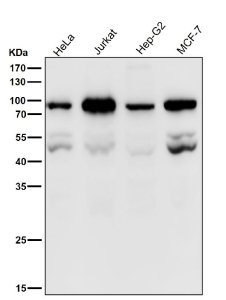 Western blot testing of human samples using the PSIP1 antibody at 1:1000 dilution for 1 hour at room temperature. A doublet is observed at ~50-55 kDa corresponding to the unmodified p75 and p52 isoforms, with an additional band at ~80â90 kDa representing post-translationally modified or complexed PSIP1 forms described in the literature.