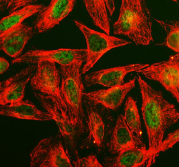Immunofluorescent staining of PPIH using anti-PPIH antibody (green) and anti-Beta Tubulin antibody (red). PPIH was detected in an immunocytochemical section of U2OS cells. Enzyme antigen retrieval was performed using IHC enzyme antigen retrieval reagent for 15 mins. The cells were blocked with 10% goat serum. And then incubated with 5 ug/ml rabbit anti-PPIH antibody and mouse anti-Beta Tubulin antibody overnight at 4oC. DyLight 488 Conjugated Goat Anti-Rabbit IgG and Cy3 Conjugated Goat Anti-Mouse IgG were used as secondary antibody at 1:500 dilution and incubated for 30 minutes at 37oC. Visualize using a fluorescence microscope and filter sets appropriate for the label used.