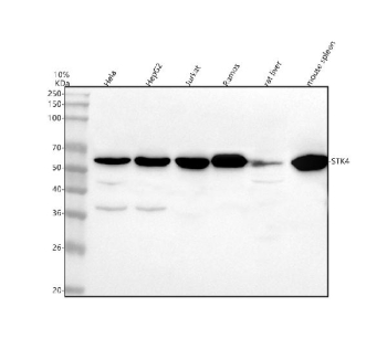 Western blot analysis of MST1/STK4 using anti-MST1 antibody. Lane 1: human Hela whole cell lysates, Lane 2: human HepG2 whole cell lysates, Lane 3: human Jurkat whole cell lysates, Lane 4: human Ramos whole cell lysates, Lane 5: rat liver tissue lysates, Lane 6: mouse spleen tissue lysates. After electrophoresis, proteins were transferred to a nitrocellulose membrane at 150 mA for 50-90 minutes. Blocked the membrane with 5% non-fat milk/TBS for 1.5 hour at RT. The membrane was incubated with rabbit anti-MST1 antibody at 0.5 ug/ml overnight at 4oC, then washed with TBS-0.1%Tween 3 times with 5 minutes each and probed with a goat anti-rabbit IgG-HRP secondary antibody at a dilution of 1:5000 for 1.5 hour at RT. The signal was developed using enhanced chemiluminescent. The predicted molecular weight of MST1/STK4 is at ~56 kDa and ~52 kDa (two isoforms).