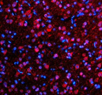 Immunofluorescent staining of SFXN4 using anti-SFXN4 antibody (red). SFXN4 was detected in a paraffin-embedded section of rat brain tissue. Heat mediated antigen retrieval was performed in EDTA buffer (pH 8.0, epitope retrieval solution). The tissue section was blocked with 10% goat serum. The tissue section was then incubated with 5 ug/ml rabbit anti-SFXN4 antibody overnight at 4oC. Cy3 Conjugated Goat Anti-Rabbit IgG was used as secondary antibody at 1:500 dilution and incubated for 30 minutes at 37oC. The section was counterstained with DAPI nuclear stain (blue). Visualize using a fluorescence microscope and filter sets appropriate for the label used.