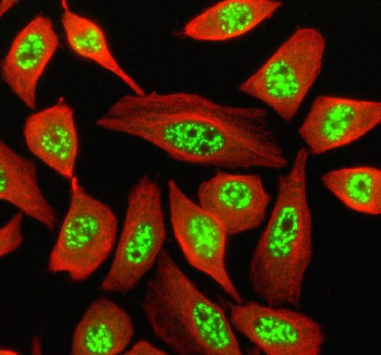Immunofluorescent staining of SON using anti-SON antibody (green) and anti-Beta Tubulin antibody (red). SON was detected in an immunocytochemical section of Siha cells. Enzyme antigen retrieval was performed using IHC enzyme antigen retrieval reagent for 15 mins. The cells were blocked with 10% goat serum. And then incubated with 5 ug/ml rabbit anti-SON antibody and mouse anti-Beta Tubulin antibody overnight at 4oC. DyLight 488 Conjugated Goat Anti-Rabbit IgG and Cy3 Conjugated Goat Anti-Mouse IgG were used as secondary antibody at 1:500 dilution and incubated for 30 minutes at 37oC. Visualize using a fluorescence microscope and filter sets appropriate for the label used.