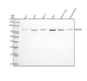 Western blot analysis of BDKRB2 using anti-BDKRB2 antibody. Lane 1: human Hela whole cell lysates, Lane 2: human 293T whole cell lysates, Lane 3: human MCF-7 whole cell lysates, Lane 4: human K562 whole cell lysates, Lane 5: mouse lung tissue lysates, Lane 6: mouse kidney tissue lysates. After electrophoresis, proteins were transferred to a nitrocellulose membrane at 150 mA for 50-90 minutes. Blocked the membrane with 5% non-fat milk/TBS for 1.5 hour at RT. The membrane was incubated with rabbit anti-BDKRB2 antibody at 1:500 overnight at 4oC, then washed with TBS-0.1%Tween 3 times with 5 minutes each and probed with a goat anti-rabbit IgG-HRP secondary antibody at a dilution of 1:500 for 1.5 hour at RT. The signal was developed using enhanced chemiluminescent. A specific band was detected for BDKRB2 at approximately 78 kDa. The expected molecular weight of BDKRB2 is ~78 kDa.
