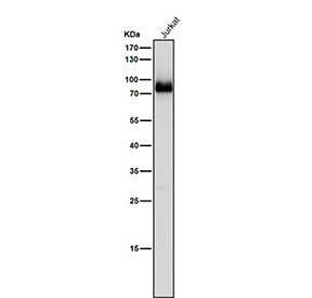Western blot testing of human Jurkat cell lysate using the Pan-PKC antibody at 1:5000 dilution for 1 hour at room temperature.