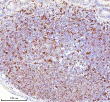 Immunohistochemical staining of Lat using anti-Lat antibody. Lat was detected in a paraffin-embedded section of rat lymph node tissue. Heat mediated antigen retrieval was performed in EDTA buffer (pH 8.0, epitope retrieval solution). The tissue section was blocked with 10% goat serum. The tissue section was then incubated with 2 ug/ml rabbit anti-Lat antibody overnight at 4oC. Peroxidase Conjugated Goat Anti-rabbit IgG was used as secondary antibody and incubated for 30 minutes at 37oC. The tissue section was developed using an HRP secondary and DAB substrate.