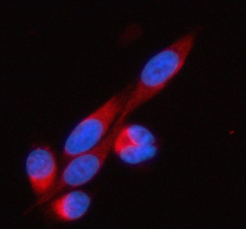 Immunofluorescent staining of SOAT1 using anti-SOAT1 antibody (red). SOAT1 was detected in an immunocytochemical section of PC-3 cells. Enzyme antigen retrieval was performed using IHC enzyme antigen retrieval reagent for 15 mins. The cells were blocked with 10% goat serum. And then incubated with 5 ug/ml rabbit anti-SOAT1 antibody overnight at 4oC. Cy3 Conjugated Goat Anti-Rabbit IgG was used as secondary antibody at 1:500 dilution and incubated for 30 minutes at 37oC. The section was counterstained with DAPI nuclear stain (blue). Visualize using a fluorescence microscope and filter sets appropriate for the label used.