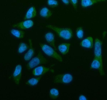 Immunofluorescent staining of OSBPL2 using anti-OSBPL2 antibody (green). OSBPL2 was detected in an immunocytochemical section of HELA cells. Enzyme antigen retrieval was performed using IHC enzyme antigen retrieval reagent for 15 mins. The cells were blocked with 10% goat serum. And then incubated with 5 ug/ml rabbit anti-OSBPL2 antibody overnight at 4oC. DyLight 488 Conjugated Goat Anti-Rabbit IgG was used as secondary antibody at 1:500 dilution and incubated for 30 minutes at 37oC. The section was counterstained with DAPI nuclear stain (blue). Visualize using a fluorescence microscope and filter sets appropriate for the label used.