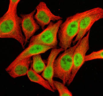 Immunofluorescent staining of SFMBT2 using anti-SFMBT2 antibody (green) and anti-Beta Tubulin antibody (red). SFMBT2 was detected in an immunocytochemical section of Hela cells. Enzyme antigen retrieval was performed using IHC enzyme antigen retrieval reagent for 15 mins. The cells were blocked with 10% goat serum. And then incubated with 5 ug/ml rabbit anti-SFMBT2 antibody and mouse anti-Beta Tubulin antibody overnight at 4oC. DyLight 488 Conjugated Goat Anti-Rabbit IgG and Cy3 Conjugated Goat Anti-Mouse IgG were used as secondary antibody at 1:500 dilution and incubated for 30 minutes at 37oC. Visualize using a fluorescence microscope and filter sets appropriate for the label used.