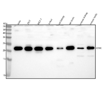 Western blot analysis of IDNK using anti-IDNK antibody. Lane 1: human Hela whole cell lysates, Lane 2: human 293T whole cell lysates, Lane 3: human MCF-7 whole cell lysates, Lane 4: human Jurkat whole cell lysates, Lane 5: rat kisney tissue lysates, Lane 6: rat testis tissue lysates, Lane 7: mouse kidney tissue lysates, Lane 8: mouse testis tissue lysates. After electrophoresis, proteins were transferred to a nitrocellulose membrane at 150 mA for 50-90 minutes. Blocked the membrane with 5% non-fat milk/TBS for 1.5 hour at RT. The membrane was incubated with rabbit anti-IDNK antibody at 0.25 ug/ml overnight at 4oC, then washed with TBS-0.1%Tween 3 times with 5 minutes each and probed with a goat anti-rabbit IgG-HRP secondary antibody at a dilution of 1:5000 for 1.5 hour at RT. The signal was developed using enhanced chemiluminescent. A specific band was detected for IDNK at approximately 21 kDa. The expected molecular weight of IDNK is ~21 kDa.