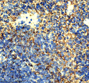 Immunohistochemical staining of ICAM1 using anti-ICAM1 antibody. ICAM1 was detected in a paraffin-embedded section of mouse spleen tissue. Heat mediated antigen retrieval was performed in EDTA buffer (pH 8.0, epitope retrieval solution). The tissue section was blocked with 10% goat serum. The tissue section was then incubated with 1:50 rabbit anti-ICAM1 antibody overnight at 4oC. Peroxidase Conjugated Goat Anti-rabbit IgG was used as secondary antibody and incubated for 30 minutes at 37oC. The tissue section was developed using an HRP secondary and DAB substrate.