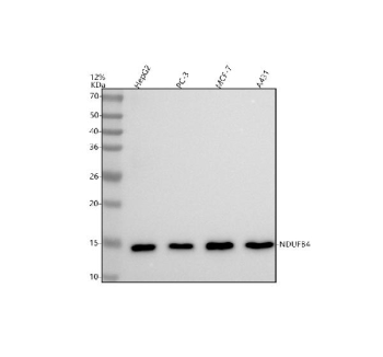 Western blot analysis of NDUFB4 using anti-NDUFB4 antibody. Lane 1: human HepG2 whole cell lysates, Lane 2: human PC-3 whole cell lysates, Lane 3: human MCF-7 whole cell lysates, Lane 4: human whole cell lysates. After electrophoresis, proteins were transferred to a nitrocellulose membrane at 150 mA for 50-90 minutes. Blocked the membrane with 5% non-fat milk/TBS for 1.5 hour at RT. The membrane was incubated with rabbit anti-NDUFB4 antibody at 1:500 overnight at 4oC, then washed with TBS-0.1%Tween 3 times with 5 minutes each and probed with a goat anti-rabbit IgG-HRP secondary antibody at a dilution of 1:500 for 1.5 hour at RT. The signal was developed using enhanced chemiluminescent. A specific band was detected for NDUFB4 at approximately 15 kDa. The expected molecular weight of NDUFB4 is ~15 kDa.