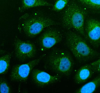 Immunofluorescent staining of THEM6 using anti-THEM6 antibody (green). THEM6 was detected in an immunocytochemical section of SIHA cells. Enzyme antigen retrieval was performed using IHC enzyme antigen retrieval reagent for 15 mins. The cells were blocked with 10% goat serum. And then incubated with 5 ug/ml rabbit anti-THEM6 antibody overnight at 4oC. DyLight 488 Conjugated Goat Anti-Rabbit IgG was used as secondary antibody at 1:500 dilution and incubated for 30 minutes at 37oC. The section was counterstained with DAPI nuclear stain (blue). Visualize using a fluorescence microscope and filter sets appropriate for the label used.