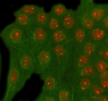 Immunofluorescent staining of RAD54L2 using anti-RAD54L2 antibody (red) and anti-Beta Tubulin antibody (green). RAD54L2 was detected in immunocytochemical section of cell. Enzyme antigen retrieval was performed using IHC enzyme antigen retrieval reagent for 15 mins. The cells were blocked with 10% goat serum. And then incubated with 5 ug/ml rabbit anti-RAD54L2 antibody and mouse anti-Beta Tubulin antibody overnight at 4oC. Cy3 Conjugated Goat Anti-Rabbit IgG and DyLight 488 Conjugated Goat Anti-Mouse IgG were used as secondary antibody at 1:500 dilution and incubated for 30 minutes at 37oC. Visualize using a fluorescence microscope and filter sets appropriate for the label used.