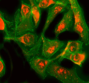 Immunofluorescent staining of GINS3 using anti-GINS3 antibody (red) and anti-Tubulin mAb (green). GINS3 was detected in an immunocytochemical section of Hela cells. Enzyme antigen retrieval was performed using IHC enzyme antigen retrieval reagent for 15 mins. The cells were blocked with 10% goat serum. And then incubated with 5 ug/ml rabbit anti-GINS3 antibody overnight at 4oC. DyLight 594 Conjugated Goat Anti-Rabbit IgG was used as secondary antibody at 1:100 dilution and incubated for 30 minutes at 37oC. The tissue section was developed using Phalloidin-iFluor 488 Conjugated. Visualize using a fluorescence microscope and filter sets appropriate for the label used.