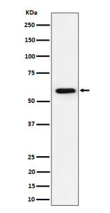 Western blot analysis of PRPF31 expression in human Jurkat cell lysate using the PRPF31 antibody. Predicted molecular weight ~55 kDa.