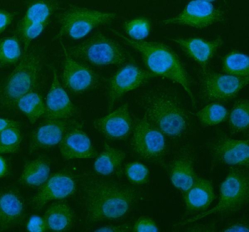 Immunofluorescent staining of MEIOB using anti-MEIOB antibody (green). MEIOB was detected in an immunocytochemical section of cells. Enzyme antigen retrieval was performed using IHC enzyme antigen retrieval reagent for 15 mins. The cells were blocked with 10% goat serum. And then incubated with 5 ug/ml rabbit anti-MEIOB antibody overnight at 4oC. DyLight 488 Conjugated Goat Anti-Rabbit IgG was used as secondary antibody at 1:500 dilution and incubated for 30 minutes at 37oC. The section was counterstained with DAPI nuclear stain (blue). Visualize using a fluorescence microscope and filter sets appropriate for the label used.