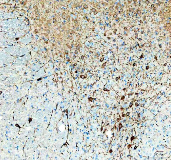 Tph2 TPH2 Antibody | Tryptophan hydroxylase 2 | FY13043
