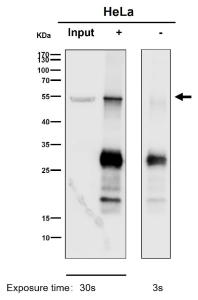 Immunoprecipitation analysis using the antibody at 1:50 dilution. Western blot at 1:1000 dilution. Predicted molecular weight: 50-56 kDa.