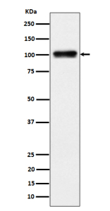 Western blot analysis of Nesprin 3 expression in human 293 cell lysate using Nesprin 3 antibody. A single band is detected at ~100 kDa, running slightly below the ~112 kDa prediction. The migration is consistent with the reported nesprin-3 isoform pattern (long form ~108-112 kDa, short form ~95-105 kDa) and the faster apparent mobility of coiled-coil nesprins on SDS-PAGE.