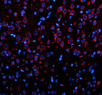 Immunofluorescent staining of OPN3 using anti-OPN3 antibody. OPN3 was detected in a paraffin-embedded section of mouse brain tissue. Heat mediated antigen retrieval was performed in EDTA buffer (pH 8.0, epitope retrieval solution). The tissue section was blocked with 10% goat serum. The tissue section was then incubated with 5 ug/ml rabbit anti-OPN3 antibody overnight at 4oC. Cy3 Conjugated Goat Anti-Rabbit IgG was used as secondary antibody at 1:500 dilution and incubated for 30 minutes at 37oC. The section was counterstained with DAPI nuclear stain (blue). Visualize using a fluorescence microscope and filter sets appropriate for the label used.