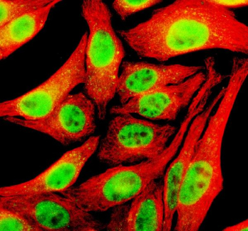 Immunofluorescent staining of TFAP4 using anti-TFAP4 antibody (green) and anti-Beta Tubulin antibody (red). TFAP4 was detected in an immunocytochemical section of Hela cells. Enzyme antigen retrieval was performed using IHC enzyme antigen retrieval reagent for 15 mins. The cells were blocked with 10% goat serum. And then incubated with 5 ug/ml rabbit anti-TFAP4 antibody and mouse anti-Beta Tubulin antibody overnight at 4oC. DyLight 488 Conjugated Goat Anti-Rabbit IgG and Cy3 Conjugated Goat Anti-Mouse IgG were used as secondary antibody at 1:500 dilution and incubated for 30 minutes at 37oC. Visualize using a fluorescence microscope and filter sets appropriate for the label used.