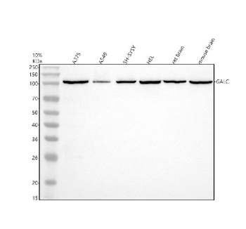 Western blot analysis of GALC using anti-GALC antibody. Electrophoresis was performed on a 10% SDS-PAGE gel at 80V (Stacking gel) / 120V (Resolving gel) for 2 hours. Lane 1: human whole cell lysates, Lane 2: human whole cell lysates, Lane 3: human SH-SY5Y whole cell lysates, Lane 4: human HEL whole cell lysates, Lane 5: rat brain tissue lysates, Lane 6: mouse brain tissue lysates. After electrophoresis, proteins were transferred to a nitrocellulose membrane at 150 mA for 50-90 minutes. Blocked the membrane with 5% non-fat milk/TBS for 1.5 hour at RT. The membrane was incubated with rabbit anti-GALC antibody at 1:1000 overnight at 4oC, then washed with TBS-0.1%Tween 3 times with 5 minutes each and probed with a goat anti-rabbit IgG-HRP secondary antibody at a dilution of 1:5000 for 1.5 hour at RT. The signal was developed using an ECL Plus Western Blotting Substrate. A single major band is detected at approximately 100 kDa, higher than the predicted molecular weight of 77 kDa. This upward shift is well documented for GALC and reflects its heavily N-glycosylated precursor form. The enzyme is synthesized as a ~100 kDa glycoprotein that is subsequently cleaved within lysosomes into smaller subunits, although only the full-length precursor is prominent in whole-cell lysates.