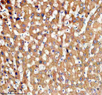 Immunohistochemical staining of TDO2 using anti-TDO2 antibody. TDO2 was detected in a paraffin-embedded section of human liver tissue. Heat mediated antigen retrieval was performed in EDTA buffer (pH 8.0, epitope retrieval solution). The tissue section was blocked with 10% goat serum. The tissue section was then incubated with 2 ug/ml rabbit anti-TDO2 antibody overnight at 4oC. Peroxidase Conjugated Goat Anti-rabbit IgG was used as secondary antibody and incubated for 30 minutes at 37oC. The tissue section was developed using an HRP secondary and DAB substrate.