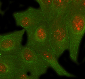 Immunofluorescent staining of SIRT6 using anti-SIRT6 antibody (red) and anti-Beta Tubulin antibody (green). SIRT6 was detected in immunocytochemical section of U2OS cell. Enzyme antigen retrieval was performed using IHC enzyme antigen retrieval reagent for 15 mins. The cells were blocked with 10% goat serum. And then incubated with 5 ug/ml rabbit anti-SIRT6 antibody and mouse anti-Beta Tubulin antibody overnight at 4oC. Cy3 Conjugated Goat Anti-Rabbit IgG and DyLight 488 Conjugated Goat Anti-Mouse IgG were used as secondary antibody at 1:500 dilution and incubated for 30 minutes at 37oC. Visualize using a fluorescence microscope and filter sets appropriate for the label used.
