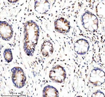 Immunohistochemical staining of GLOD5 using anti-GLOD5 antibody. GLOD5 was detected in a paraffin-embedded section of human stomach tissue. Heat mediated antigen retrieval was performed in EDTA buffer (pH 8.0, epitope retrieval solution). The tissue section was blocked with 10% goat serum. The tissue section was then incubated with 2 ug/ml rabbit anti-GLOD5 antibody overnight at 4oC. Peroxidase Conjugated Goat Anti-rabbit IgG was used as secondary antibody and incubated for 30 minutes at 37oC. The tissue section was developed using an HRP secondary and DAB substrate.