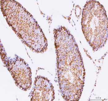 Immunohistochemical staining of STK16 using anti-STK16 antibody. STK16 was detected in a paraffin-embedded section of rat testis tissue. Heat mediated antigen retrieval was performed in EDTA buffer (pH 8.0, epitope retrieval solution). The tissue section was blocked with 10% goat serum. The tissue section was then incubated with 2 ug/ml rabbit anti-STK16 antibody overnight at 4oC. Peroxidase Conjugated Goat Anti-rabbit IgG was used as secondary antibody and incubated for 30 minutes at 37oC. The tissue section was developed using an HRP secondary and DAB substrate.