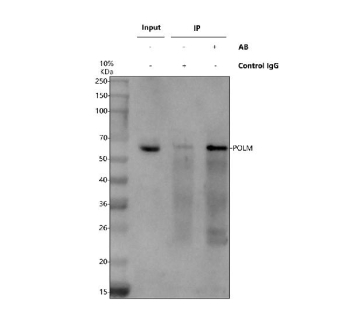 Immunoprecipitating POLM in 293T whole cell lysate. Western blot analysis of POLM using anti-POLM antibody. Lane 1: 293T whole cell lysates (30ug), Lane 2: Rabbit control IgG instead of anti-POLM antibody in 293T whole cell lysate, Lane 3: anti-POLM antibody (2ug) + 293T whole cell lysate (500ug). After electrophoresis, proteins were transferred to a membrane. Then the membrane was incubated with rabbit anti-POLM antibody at a dilution of 0.5 ug/ml and probed with a mouse anti-rabbit IgG-HRP secondary antibody. The signal is developed using ECL Plus Western Blotting Substrate. A specific band was detected for POLM at approximately 55 kDa. The expected molecular weight of POLM is ~55 kDa.