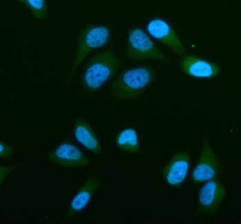 Immunofluorescent staining of STRN3 using anti-STRN3 antibody (green). STRN3 was detected in an immunocytochemical section of human HELA cells. Enzyme antigen retrieval was performed using IHC enzyme antigen retrieval reagent for 15 mins. The cells were blocked with 10% goat serum. And then incubated with 5 ug/ml rabbit anti-STRN3 antibody overnight at 4oC. DyLight 488 Conjugated Goat Anti-Rabbit IgG was used as secondary antibody at 1:500 dilution and incubated for 30 minutes at 37oC. The section was counterstained with DAPI nuclear stain (blue). Visualize using a fluorescence microscope and filter sets appropriate for the label used.