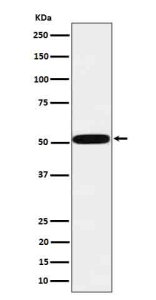 Western blot analysis of HtrA1 in human MCF7 cell lysate using HTRA1 antibody. Predicted molecular weight ~51 kDa.